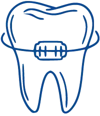 Traitements orthodontiques Orthodent — appareil classique, lingual, gouttières